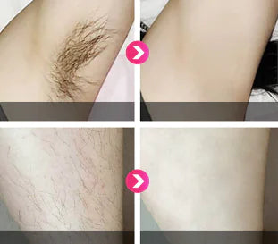 IPL Hair Removal Device and Photon Skin Rejuvenator